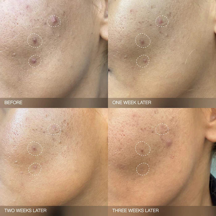 Topicals Faded Brightening Serum for Dark Spots and Discoloration (UNSCENTED)