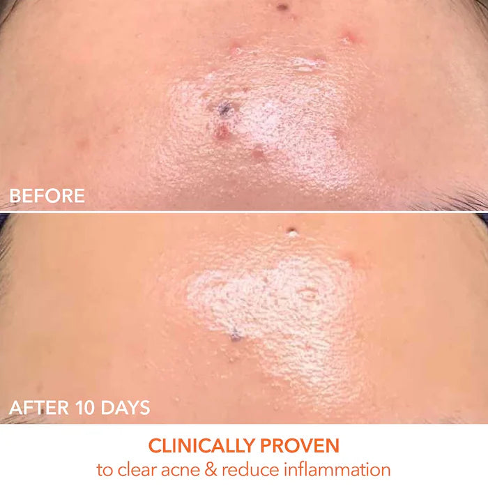 Dr. Dennis Gross Skincare 
DRx SpectraLite™ FaceWare Pro