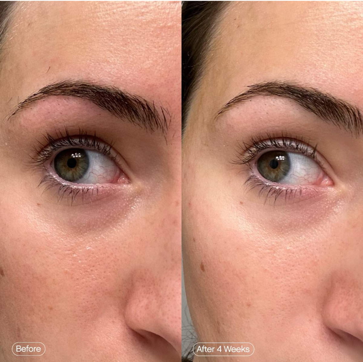 Topicals Faded Under Eye Brightening & Clearing Eye Masks