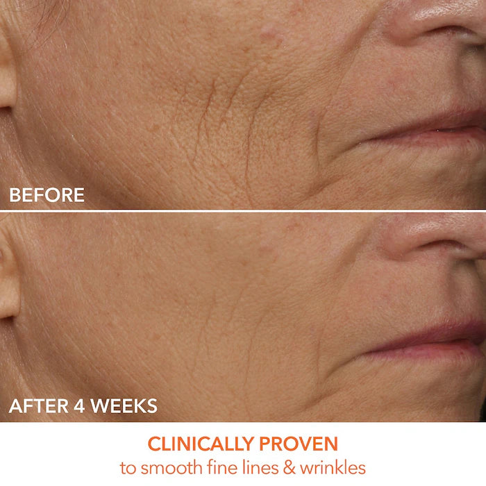 Dr. Dennis Gross Skincare 
DRx SpectraLite™ FaceWare Pro