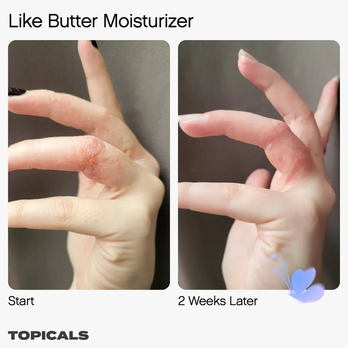 Topicals  Like Butter Moisturizer for Dry, Sensitive & Eczema-Prone Skin