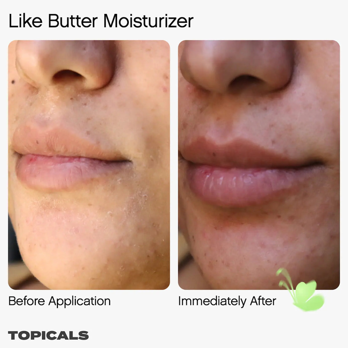 Topicals  Like Butter Moisturizer for Dry, Sensitive & Eczema-Prone Skin