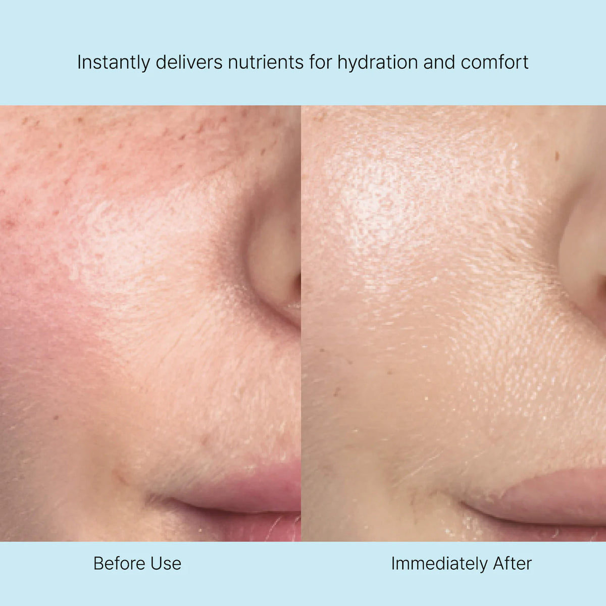 Rejuran Nutritive Cream c-PDRN® 0.2% Nourishing Moisturizer for Visible Firmness & Barrier Support